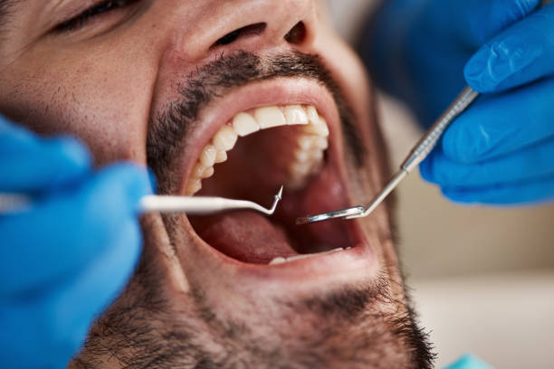 Best Broken or Cracked Tooth Emergency Dentist in Vinton, TX